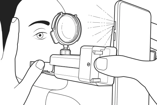 Instrucciones de uso del retinoscopio